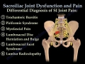 Sacroiliac Joint Dysfunction Animation - Everything You Need To Know - Dr Nabil Ebraheim MD